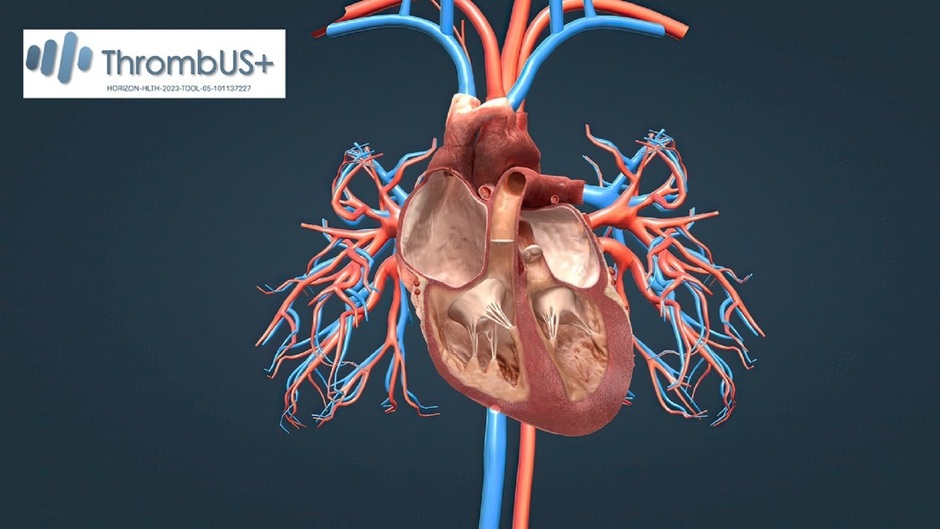 EU-Projekt entwickelt tragbares Diagnostikgerät zur Früherkennung von Venenthrombosen